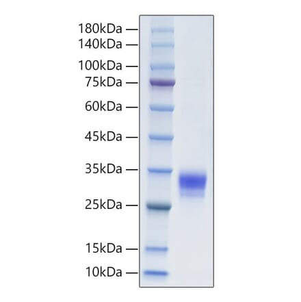 SDS-PAGE - Recombinant Human CTHRC1 Protein (C-terminal His Tag) (A330490) - Antibodies.com
