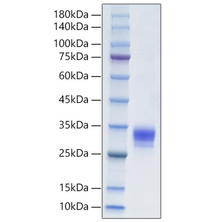 SDS-PAGE - Recombinant Human CTHRC1 Protein (C-terminal His Tag) (A330490) - Antibodies.com