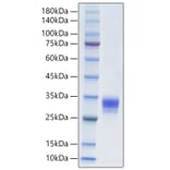 SDS-PAGE - Recombinant Human CTHRC1 Protein (C-terminal His Tag) (A330490) - Antibodies.com