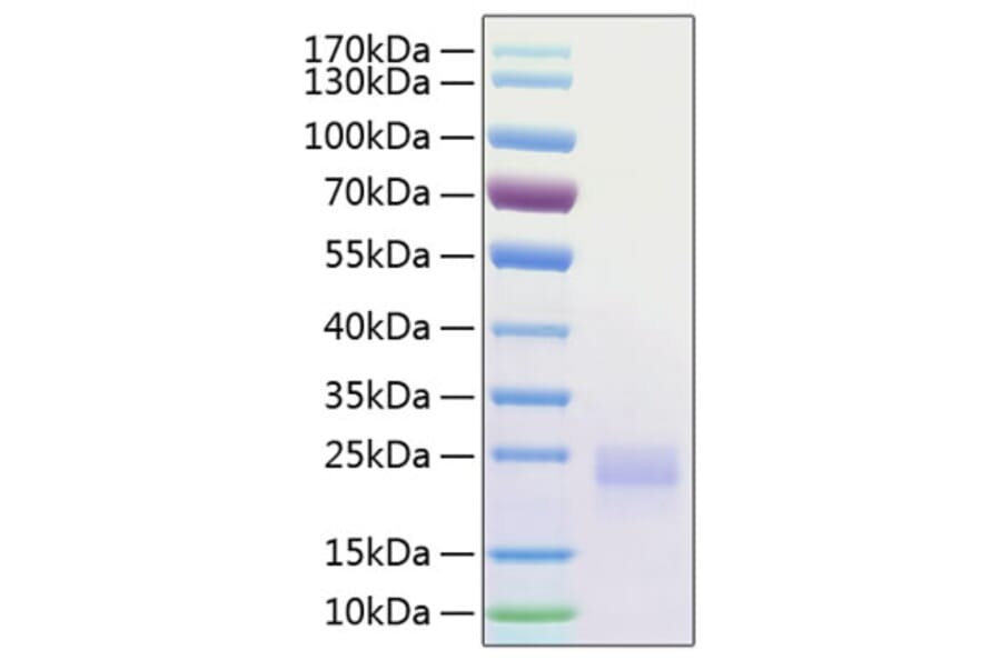 SDS-PAGE - Recombinant Human CTLA4 Protein (C-terminal His Tag) (A330491) - Antibodies.com