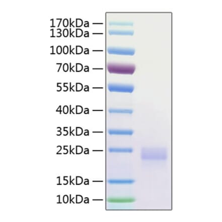 SDS-PAGE - Recombinant Human CTLA4 Protein (C-terminal His Tag) (A330491) - Antibodies.com