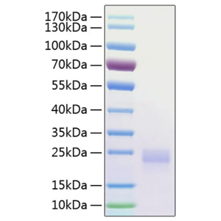 SDS-PAGE - Recombinant Human CTLA4 Protein (C-terminal His Tag) (A330491) - Antibodies.com