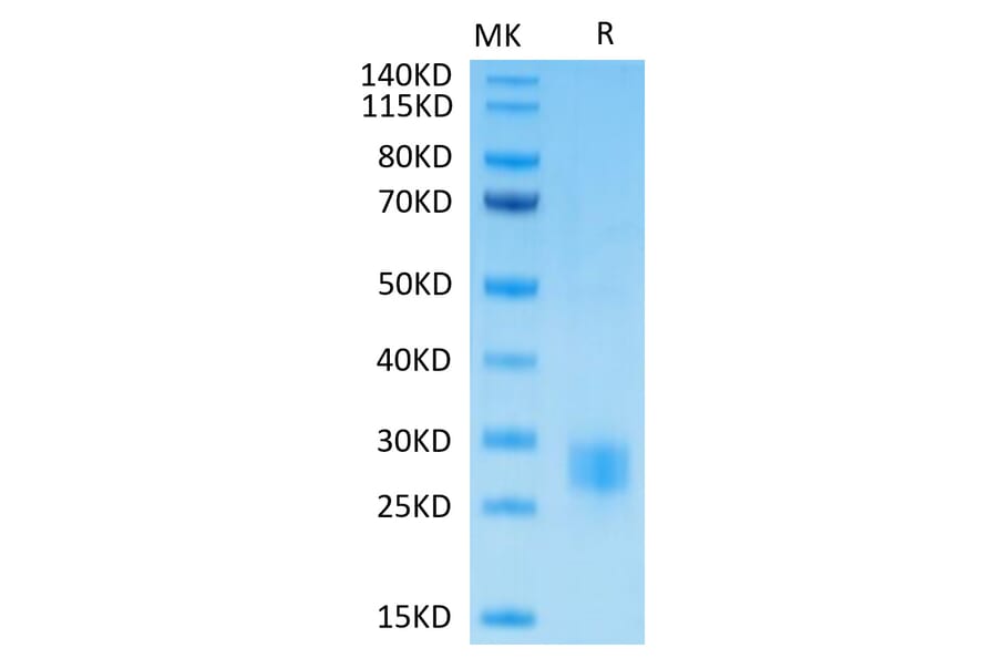 Tris-Bis PAGE - Recombinant Human CTLA4 Protein (Biotin) (C-terminal His and Avi Tag) (A330492) - Antibodies.com