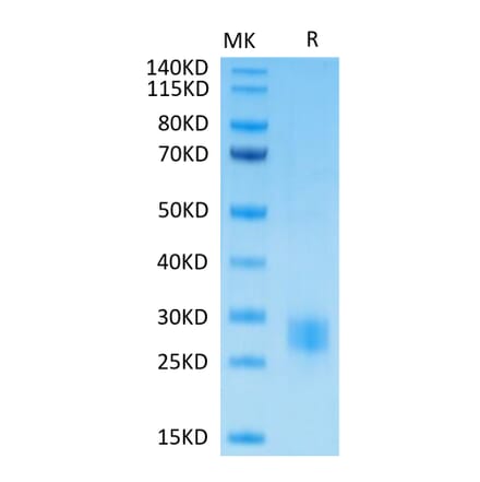 Tris-Bis PAGE - Recombinant Human CTLA4 Protein (Biotin) (C-terminal His and Avi Tag) (A330492) - Antibodies.com