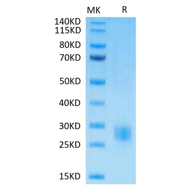 Tris-Bis PAGE - Recombinant Human CTLA4 Protein (Biotin) (C-terminal His and Avi Tag) (A330492) - Antibodies.com