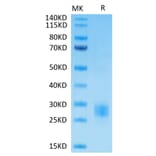 Tris-Bis PAGE - Recombinant Human CTLA4 Protein (Biotin) (C-terminal His and Avi Tag) (A330492) - Antibodies.com