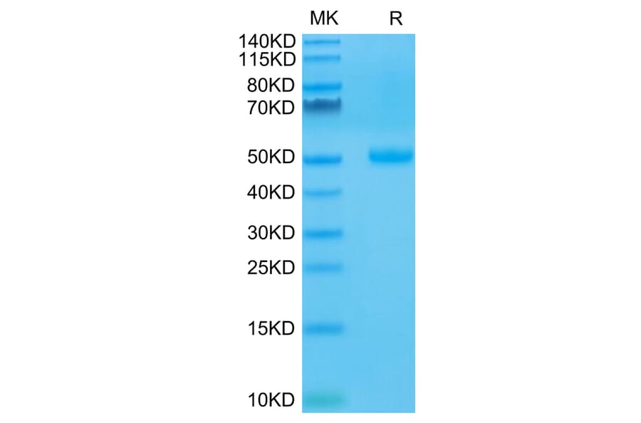 Tris-Bis PAGE - Recombinant Human CTLA4 Protein (C-terminal Human Fc Tag) (A330493) - Antibodies.com