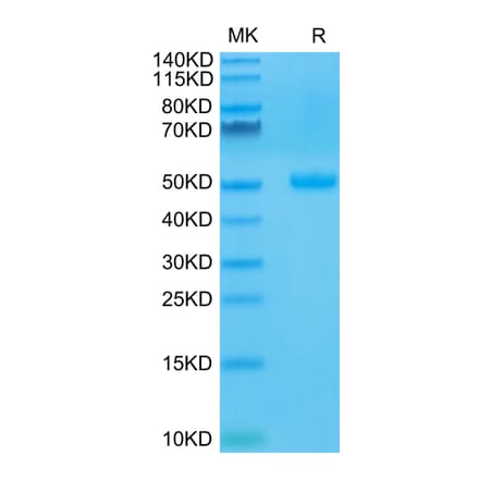 Tris-Bis PAGE - Recombinant Human CTLA4 Protein (C-terminal Human Fc Tag) (A330493) - Antibodies.com