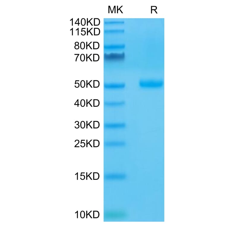 Tris-Bis PAGE - Recombinant Human CTLA4 Protein (C-terminal Human Fc Tag) (A330493) - Antibodies.com
