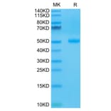 Tris-Bis PAGE - Recombinant Human CTLA4 Protein (C-terminal Human Fc Tag) (A330493) - Antibodies.com