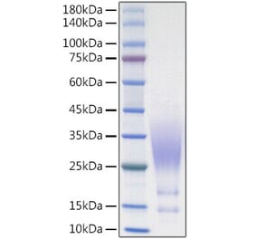 SDS-PAGE - Recombinant Human CX3CL1 Protein (C-terminal His Tag) (A330494) - Antibodies.com