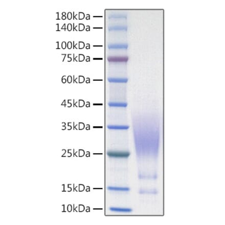 SDS-PAGE - Recombinant Human CX3CL1 Protein (C-terminal His Tag) (A330494) - Antibodies.com