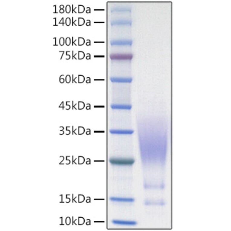 SDS-PAGE - Recombinant Human CX3CL1 Protein (C-terminal His Tag) (A330494) - Antibodies.com
