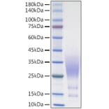 SDS-PAGE - Recombinant Human CX3CL1 Protein (C-terminal His Tag) (A330494) - Antibodies.com