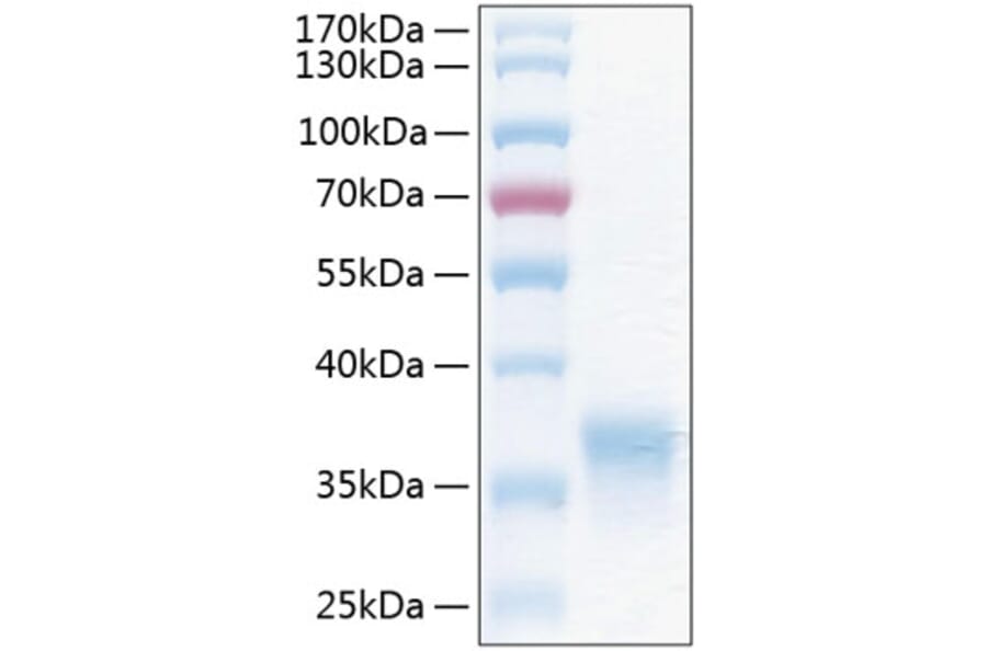 SDS-PAGE - Recombinant Human CXADR Protein (C-terminal His Tag) (A330495) - Antibodies.com