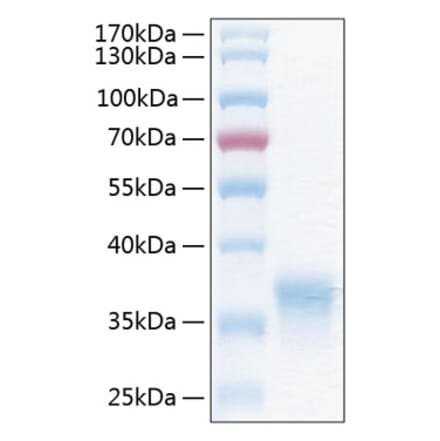 SDS-PAGE - Recombinant Human CXADR Protein (C-terminal His Tag) (A330495) - Antibodies.com
