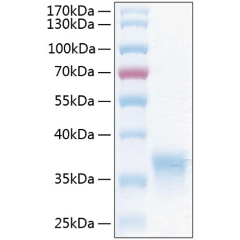 SDS-PAGE - Recombinant Human CXADR Protein (C-terminal His Tag) (A330495) - Antibodies.com