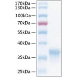 SDS-PAGE - Recombinant Human CXADR Protein (C-terminal His Tag) (A330495) - Antibodies.com