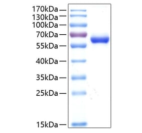 SDS-PAGE - Recombinant Human CXADR Protein (C-terminal Human Fc and His Tag) (A330496) - Antibodies.com