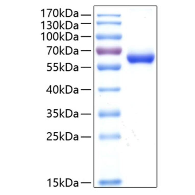 SDS-PAGE - Recombinant Human CXADR Protein (C-terminal Human Fc and His Tag) (A330496) - Antibodies.com