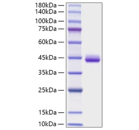 SDS-PAGE - Recombinant Human CXCL1 Protein (C-terminal Human Fc Tag) (A330497) - Antibodies.com