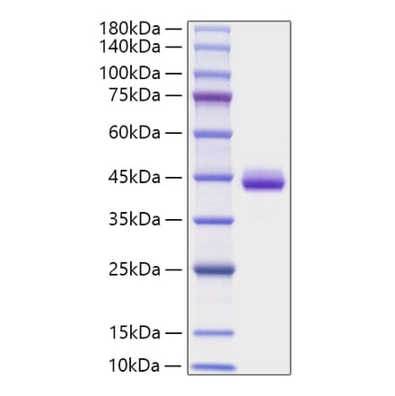 SDS-PAGE - Recombinant Human CXCL1 Protein (C-terminal Human Fc Tag) (A330497) - Antibodies.com