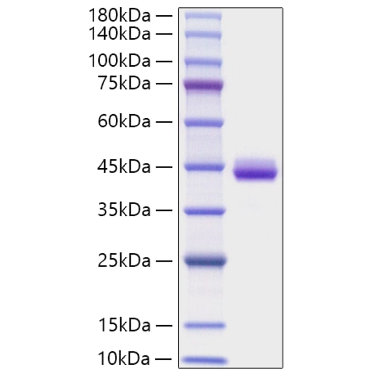 SDS-PAGE - Recombinant Human CXCL1 Protein (C-terminal Human Fc Tag) (A330497) - Antibodies.com