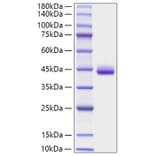 SDS-PAGE - Recombinant Human CXCL1 Protein (C-terminal Human Fc Tag) (A330497) - Antibodies.com