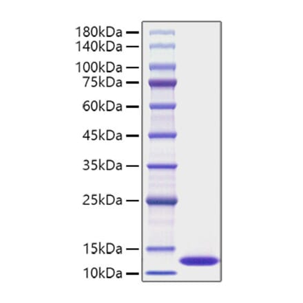 SDS-PAGE - Recombinant Human CXCL1 Protein (A330498) - Antibodies.com
