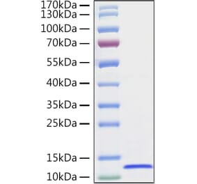 SDS-PAGE - Recombinant Human CXCL14 Protein (C-terminal His Tag) (A330502) - Antibodies.com