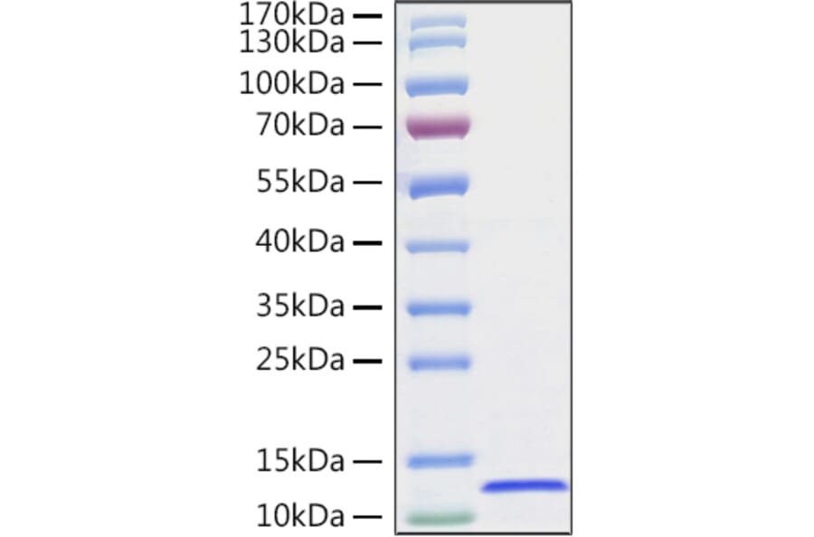 SDS-PAGE - Recombinant Human CXCL14 Protein (C-terminal His Tag) (A330502) - Antibodies.com