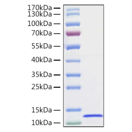 SDS-PAGE - Recombinant Human CXCL14 Protein (C-terminal His Tag) (A330502) - Antibodies.com