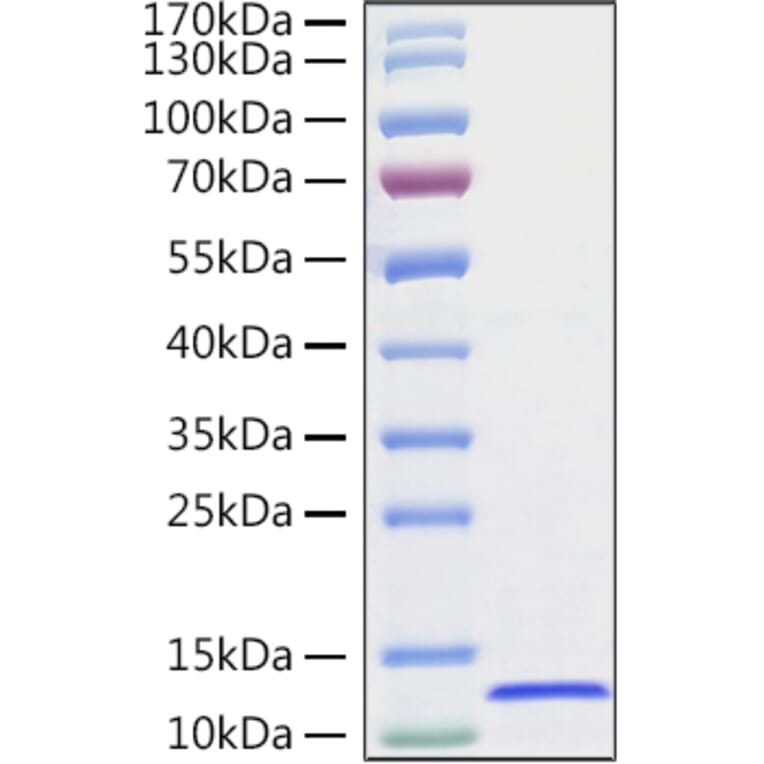 SDS-PAGE - Recombinant Human CXCL14 Protein (C-terminal His Tag) (A330502) - Antibodies.com