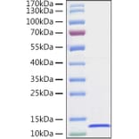SDS-PAGE - Recombinant Human CXCL14 Protein (C-terminal His Tag) (A330502) - Antibodies.com