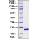 SDS-PAGE - Recombinant Human CXCL2 Protein (A330503) - Antibodies.com