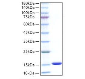 SDS-PAGE - Recombinant Human CXCL5 Protein (C-terminal His Tag) (A330505) - Antibodies.com