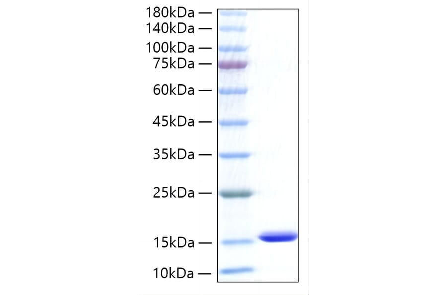 SDS-PAGE - Recombinant Human CXCL5 Protein (C-terminal His Tag) (A330505) - Antibodies.com