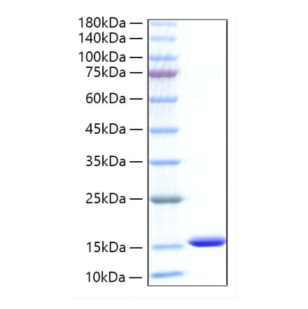 SDS-PAGE - Recombinant Human CXCL5 Protein (C-terminal His Tag) (A330505) - Antibodies.com