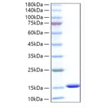 SDS-PAGE - Recombinant Human CXCL5 Protein (C-terminal His Tag) (A330505) - Antibodies.com