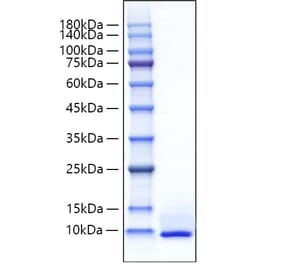 SDS-PAGE - Recombinant Mouse CXCL5 Protein (C-terminal His Tag) (A330506) - Antibodies.com