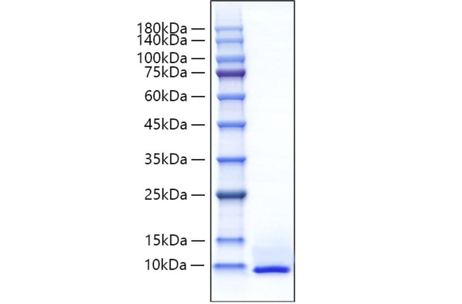 SDS-PAGE - Recombinant Mouse CXCL5 Protein (C-terminal His Tag) (A330506) - Antibodies.com