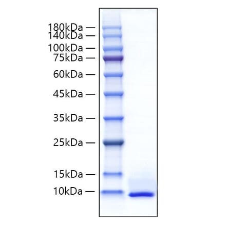 SDS-PAGE - Recombinant Mouse CXCL5 Protein (C-terminal His Tag) (A330506) - Antibodies.com