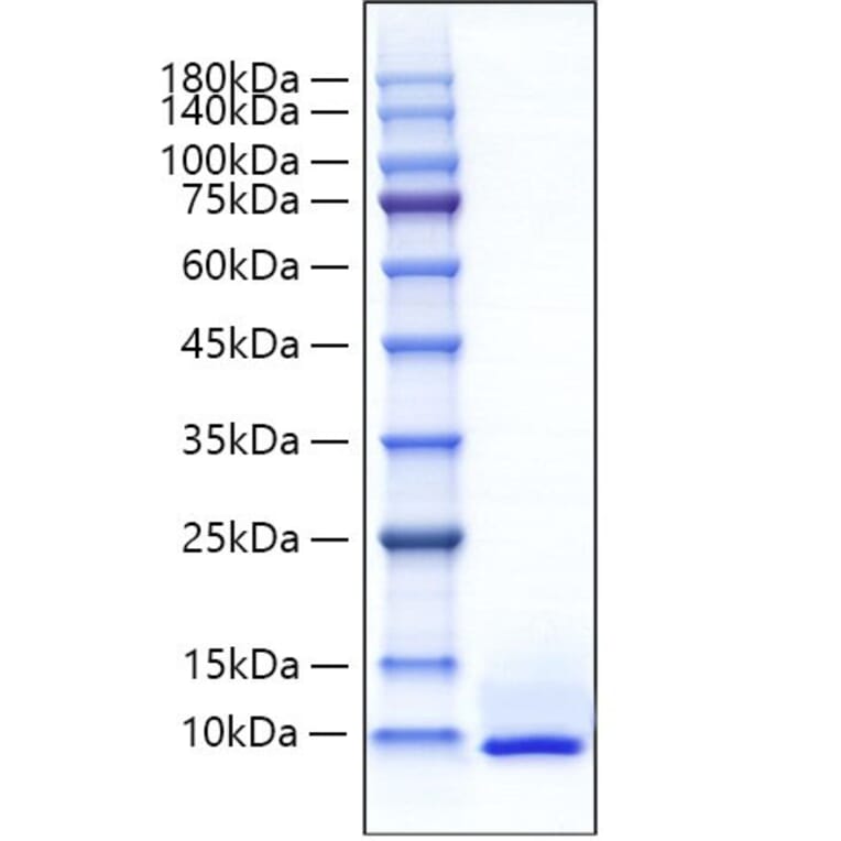 SDS-PAGE - Recombinant Mouse CXCL5 Protein (C-terminal His Tag) (A330506) - Antibodies.com