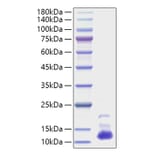 SDS-PAGE - Recombinant Human CXCL7/PBP Protein (A330507) - Antibodies.com