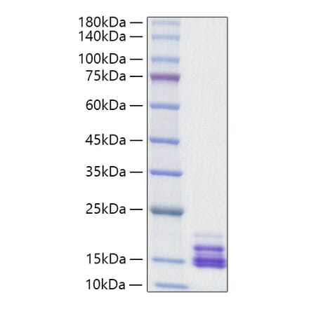 SDS-PAGE - Recombinant Human CXCL9 Protein (A330508) - Antibodies.com
