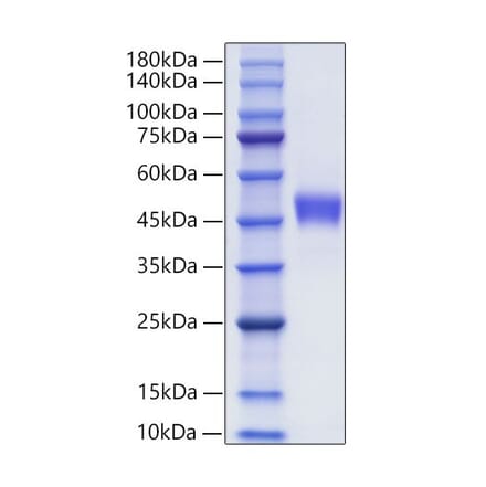 SDS-PAGE - Recombinant Human CXCR1 Protein (C-terminal Human Fc Tag) (A330509) - Antibodies.com