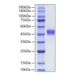SDS-PAGE - Recombinant Human CXCR1 Protein (C-terminal Human Fc Tag) (A330509) - Antibodies.com