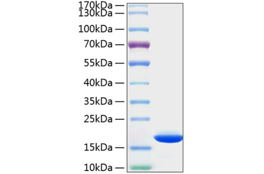 SDS-PAGE - Recombinant Human Cyclophilin B Protein (C-terminal His Tag) (A330511) - Antibodies.com