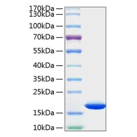 SDS-PAGE - Recombinant Human Cyclophilin B Protein (C-terminal His Tag) (A330511) - Antibodies.com