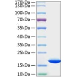 SDS-PAGE - Recombinant Human Cyclophilin B Protein (C-terminal His Tag) (A330511) - Antibodies.com